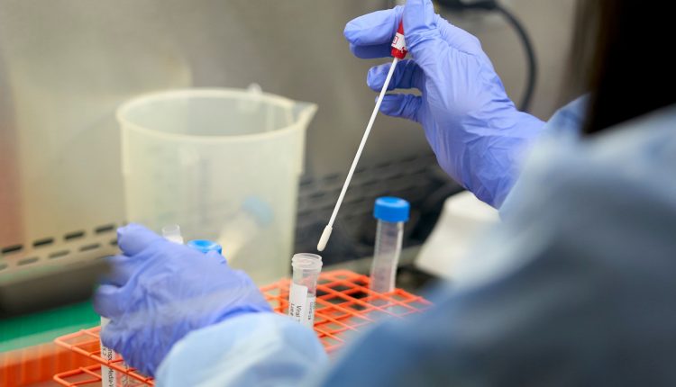 Minnesota confirms first known US case of contagious strain

