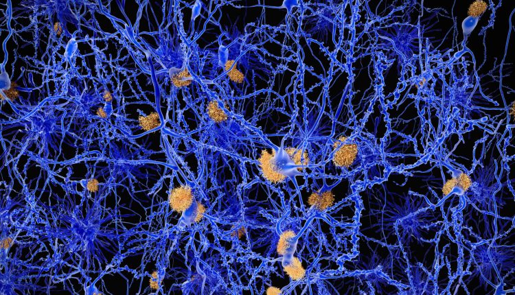 Eli Lilly recruits black patients for Alzheimer's study, drugmakers strive for diversity

