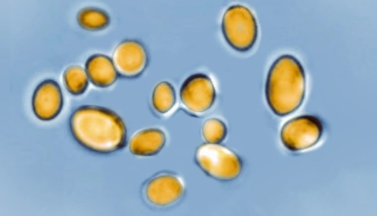 Fungal drug resistance is spreading fast, CDC says

