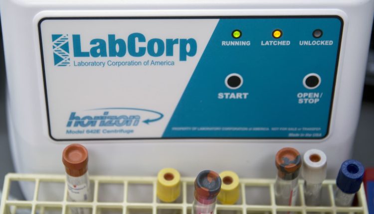 Labcorp has to pay $2.1 million to settle the DOJ's lawsuit alleging overbilling by the Department of Defense

