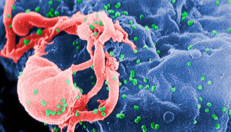 HIV infections are declining, but most at-risk people are not on PrEP

