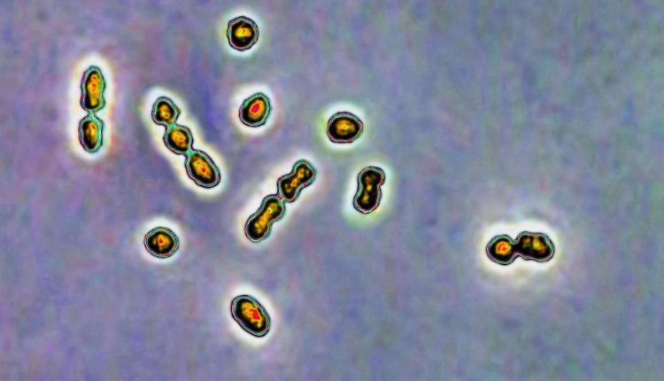 Pfizer group B streptococcal vaccine for infants delivers strong study results

